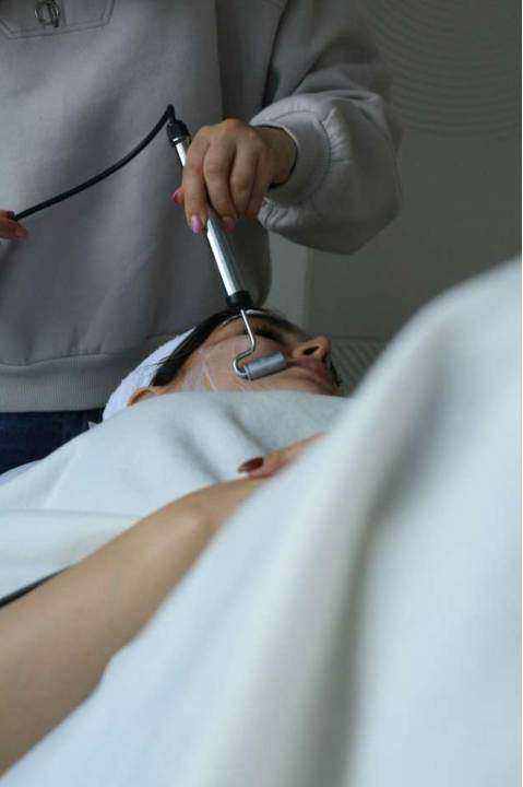 Chemical peel