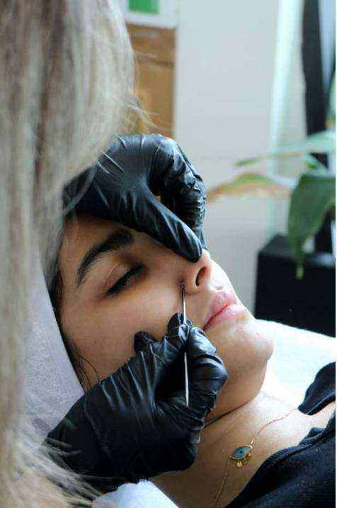 IPL device